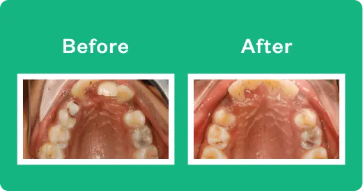 invisalign doctors site