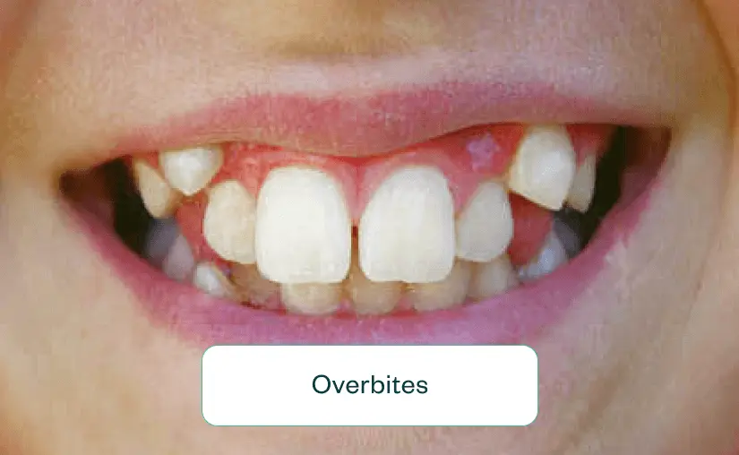 invisalign near me