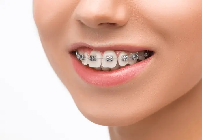 invisalign doctors site