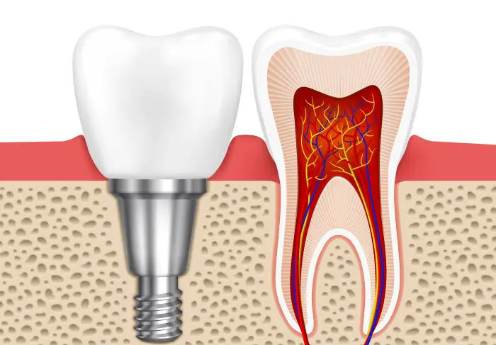 invisalign prices in india